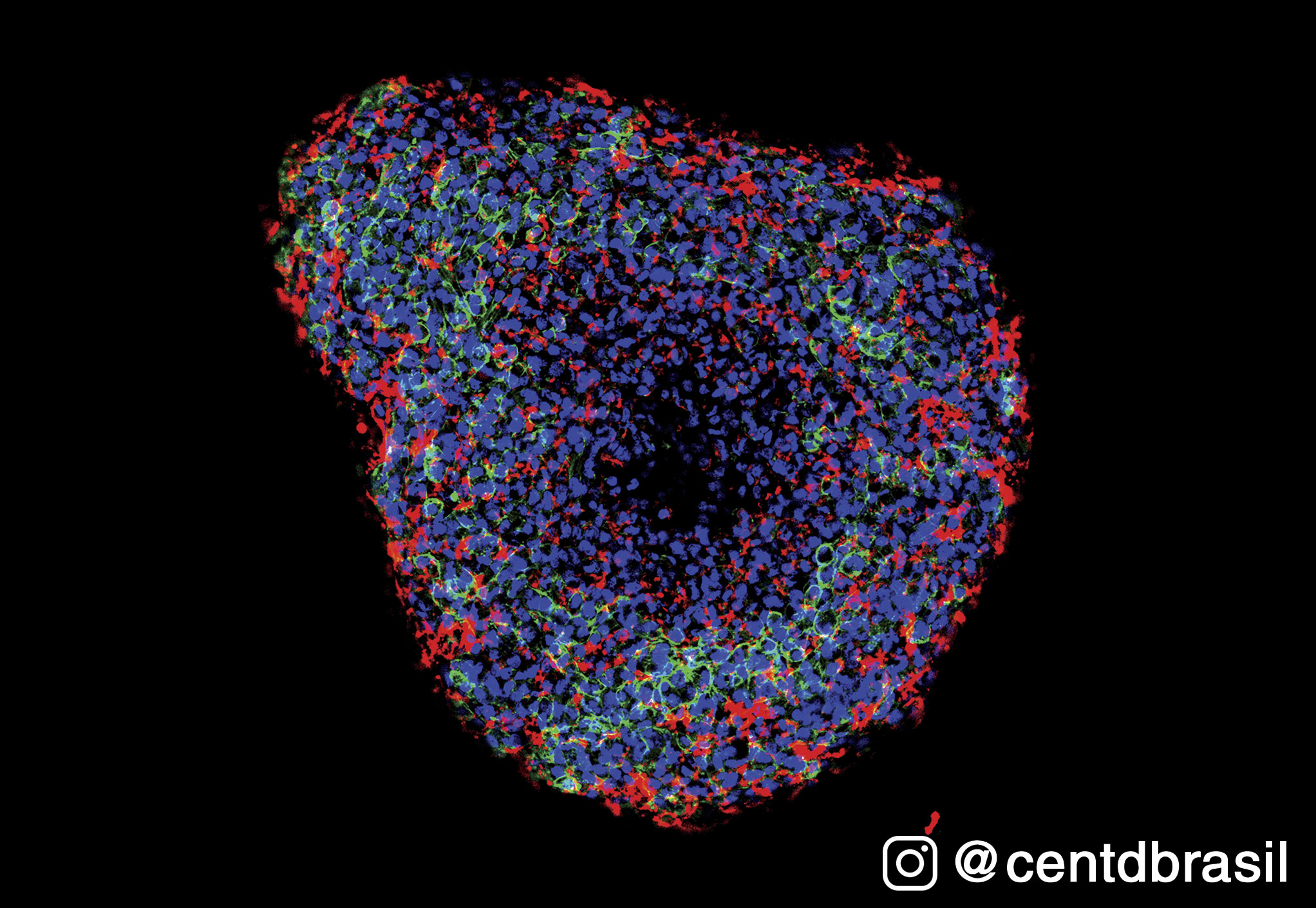 Complexidade