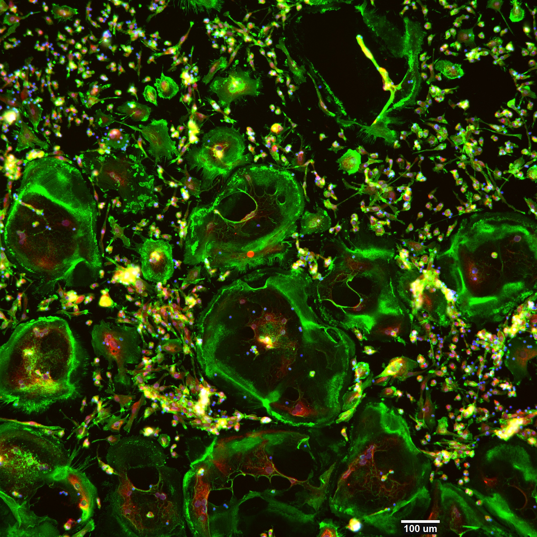 Diferenciação de células mononucleares do sangue periférico humano em osteoclastos