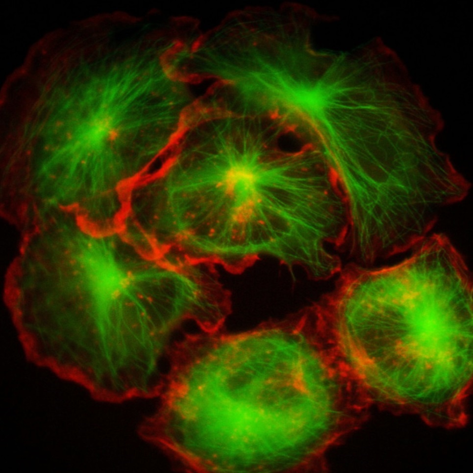 Organização do citoesqueleto de células tumorais humanas